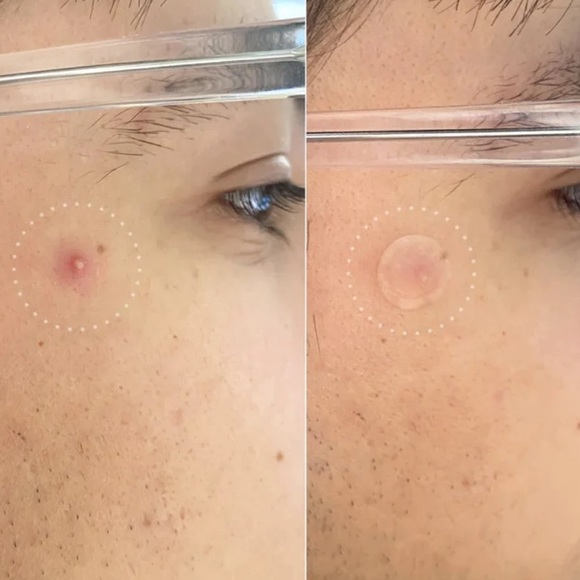 Hero Mighty Patch Invisible+ - Picture 6 of 11